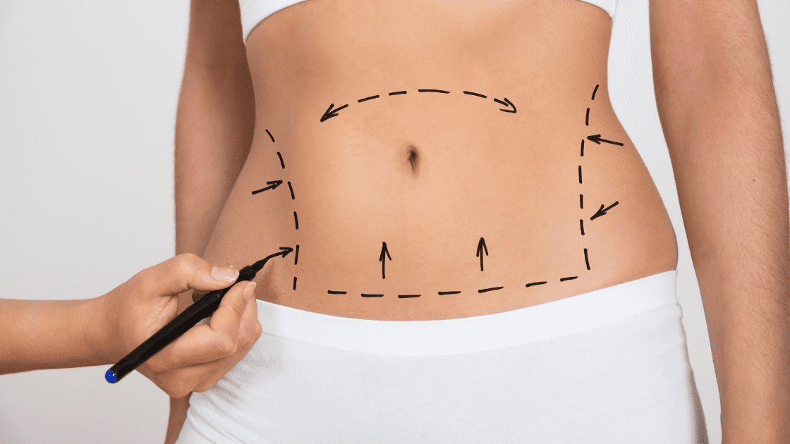 A Step-by-Step Look at Lipoma Removal