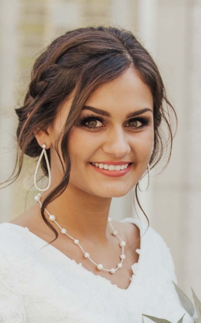 Ceramic And Plastic Aligners Are Readily Available