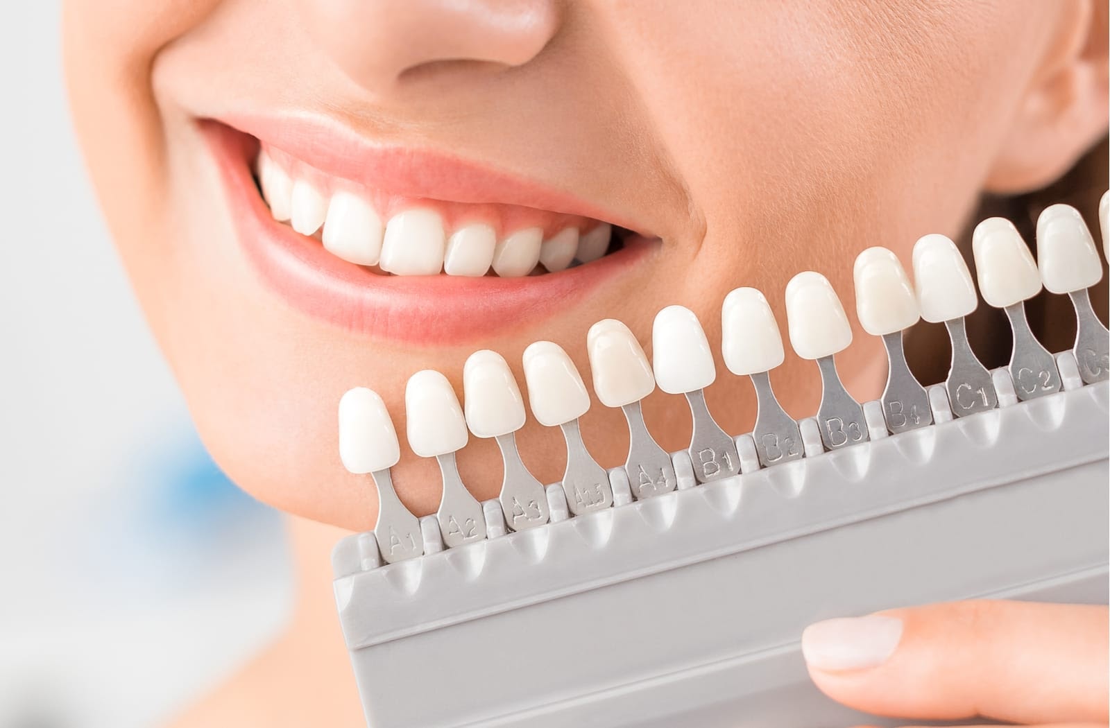 Teeth Whitening - What You Need to Know