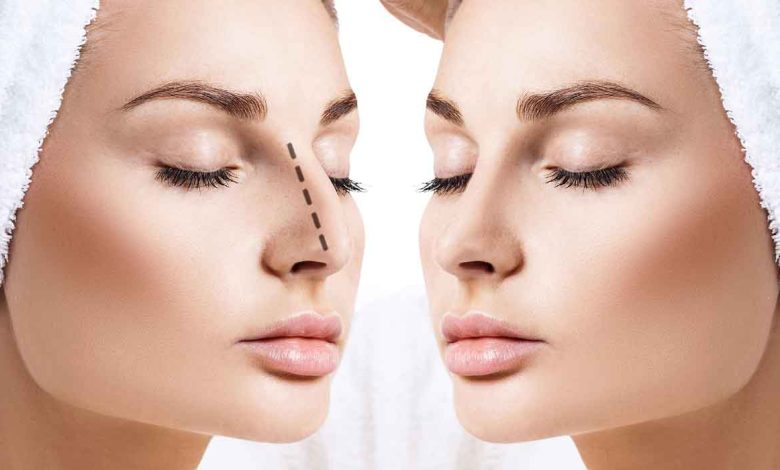 ما الذي يجب أن تعرفه عن جراحة تجميل الأنف؟