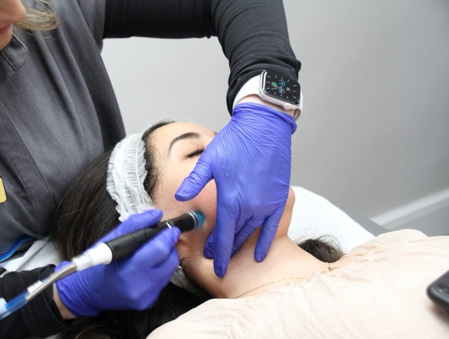Blepharoplasty