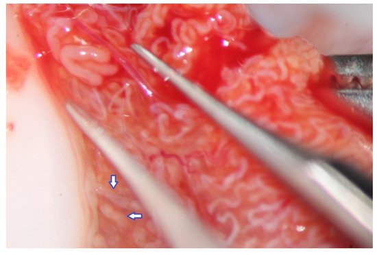 عملية التفتيش المجهري للخصية