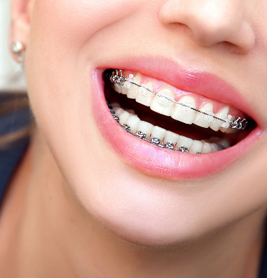 Invisalign Shifts Teeth To The Right Position