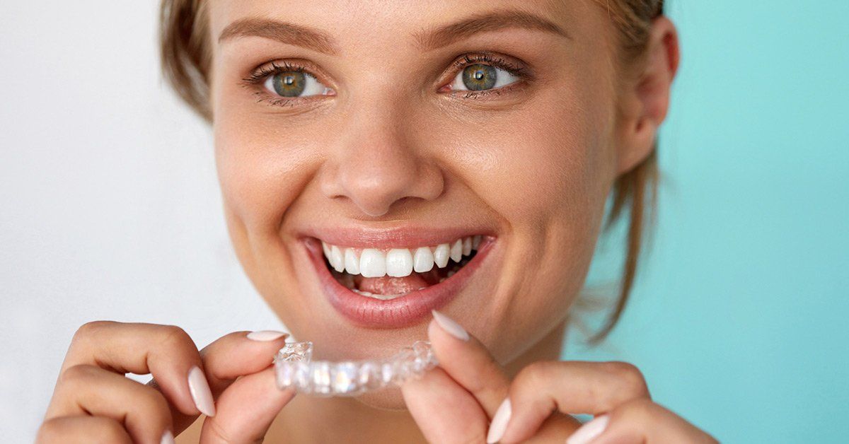 How Does Invisalign Work? And Its Importance.