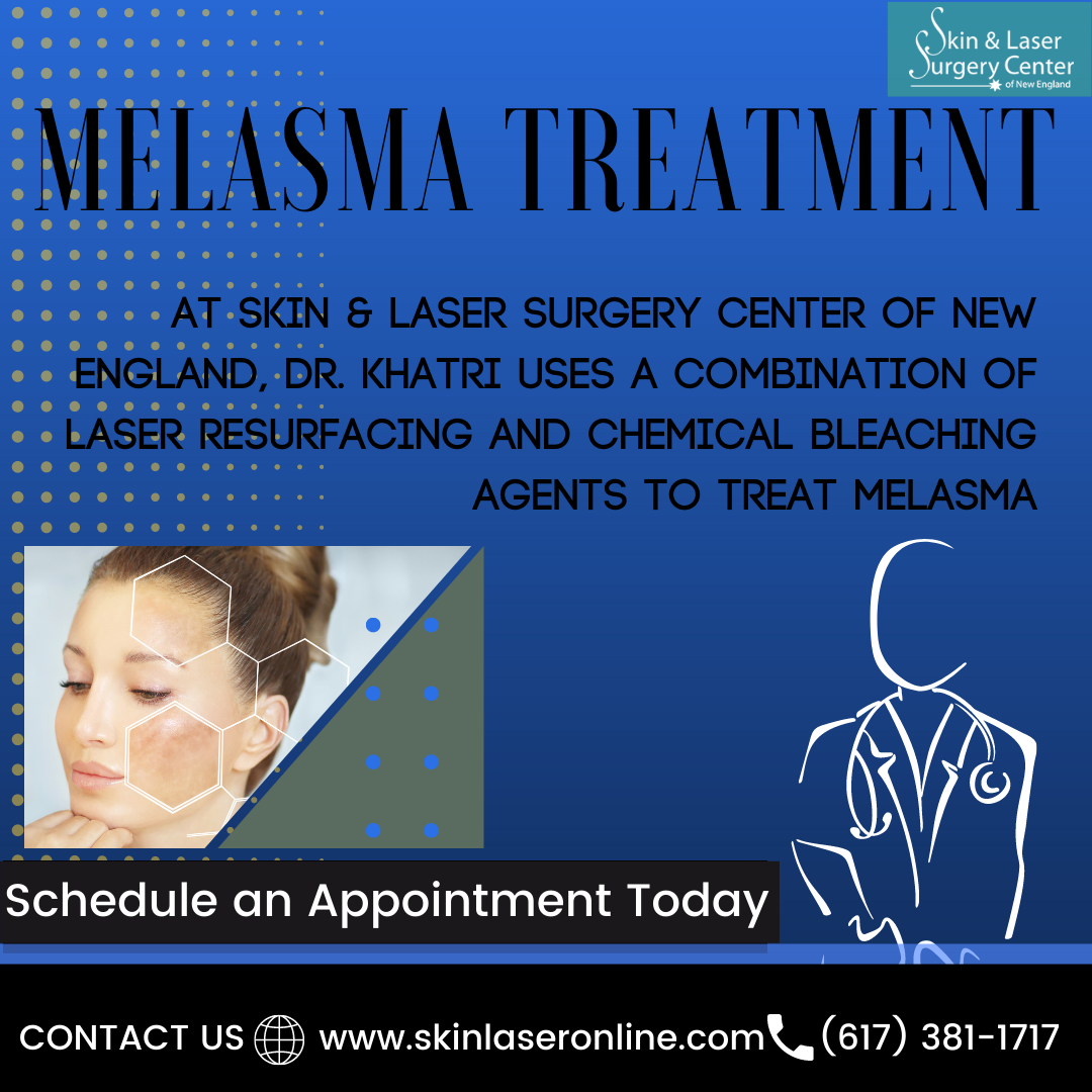 Melasma Skin Treatment 
