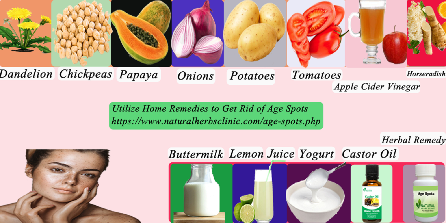 Natural Remedies for Age Spots