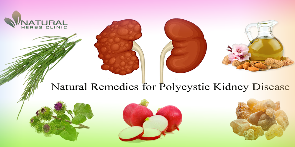 Easy Natural Remedies for Polycystic Kidney Disease and Diet Plan for PKD