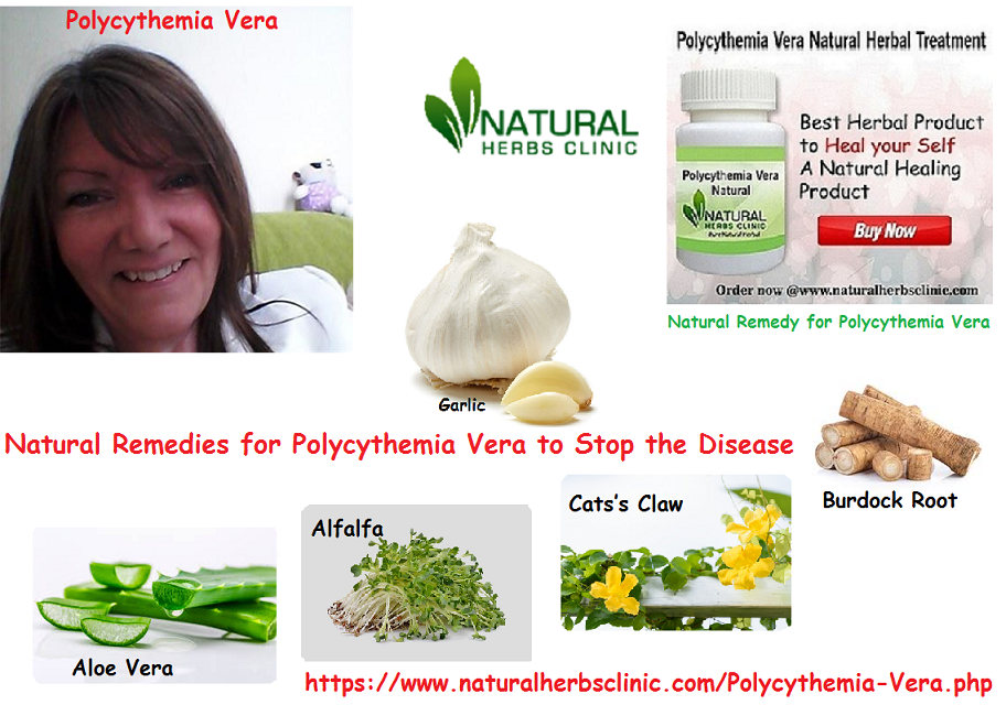 5 Natural Remedies for Polycythemia Vera to Stop the Disease
