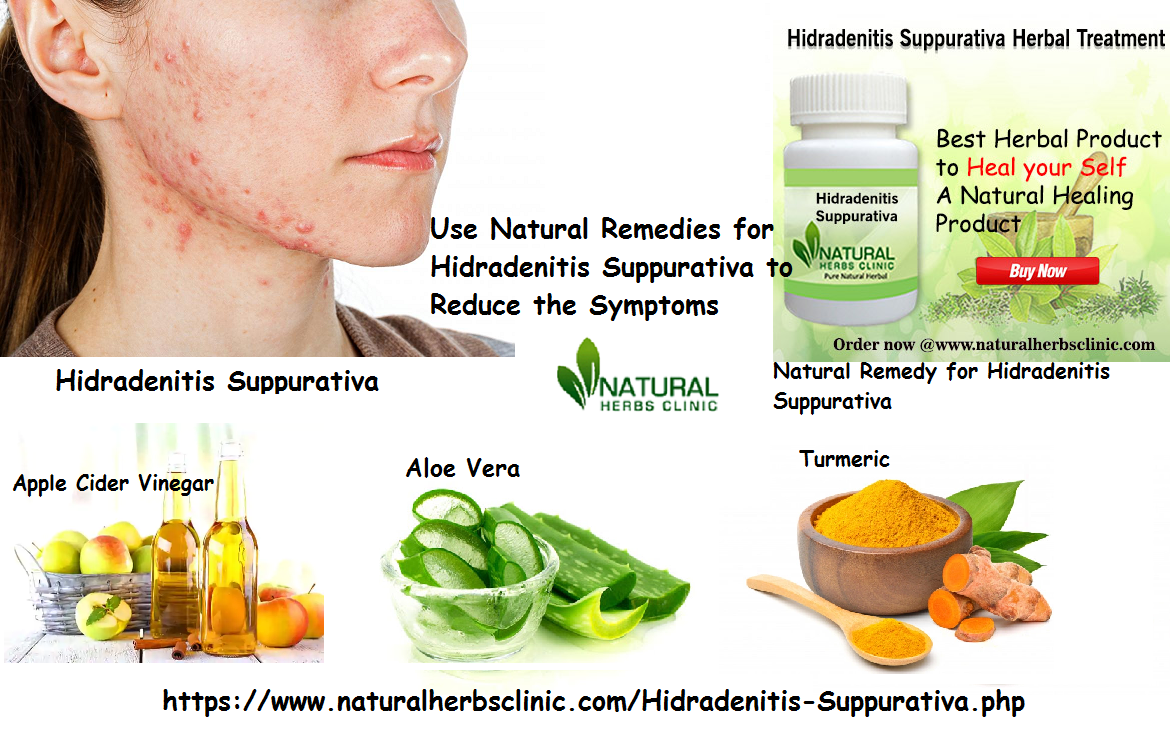 Use Natural Remedies for Hidradenitis Suppurativa to Reduce the Symptoms