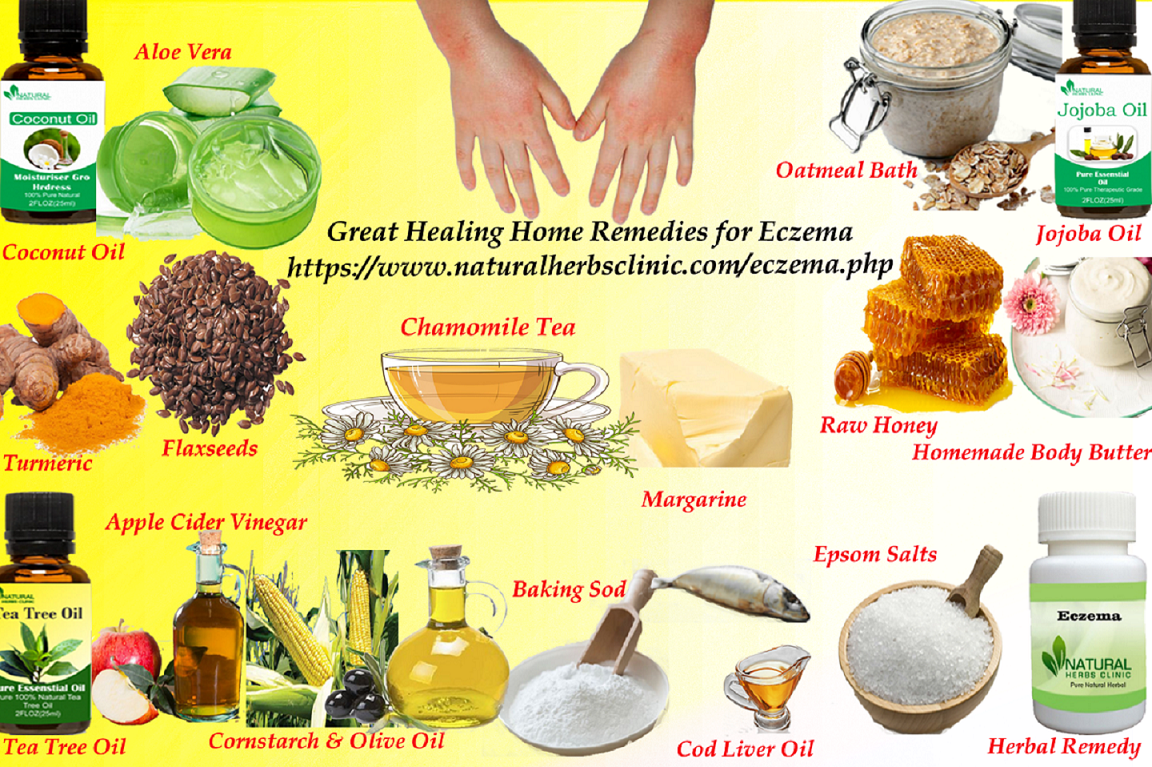 16 Great Healing Home Remedies for Eczema