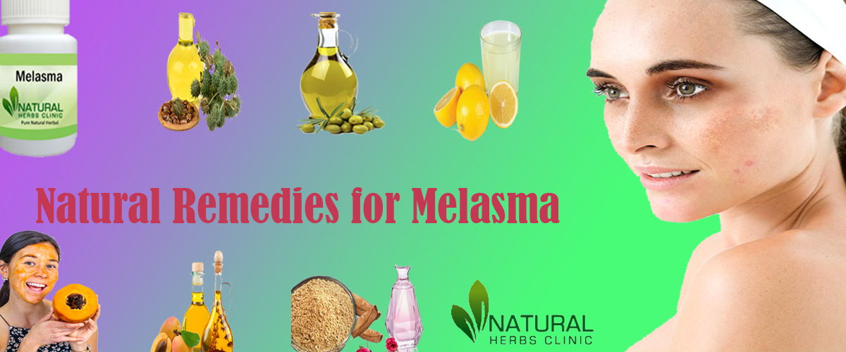 Natural Remedies for Melasma