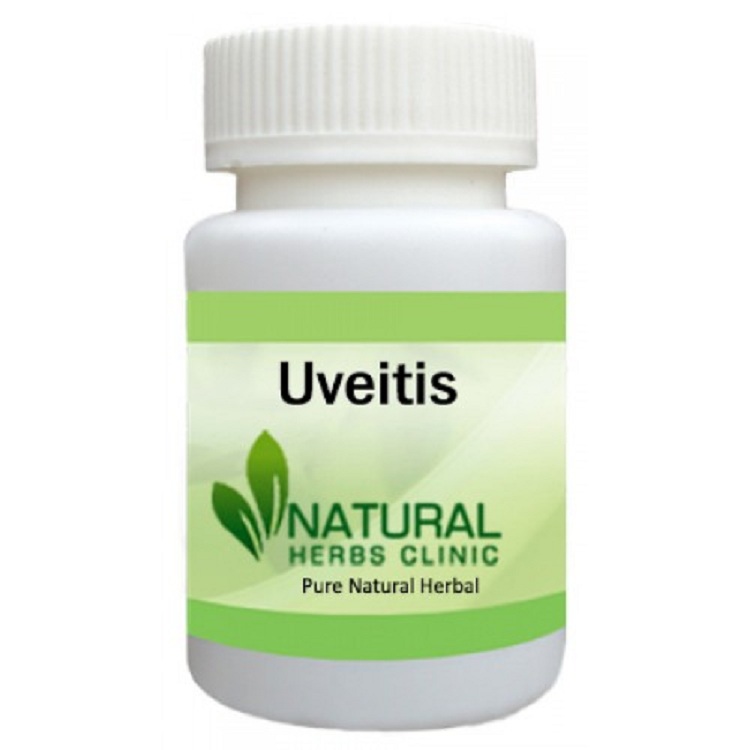 Herbal Treatment for Uveitis - Natural Herbs Clinic