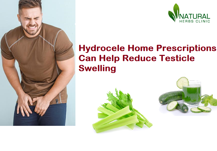 Hydrocele Home Prescriptions Can Help Reduce Testicle Swelling