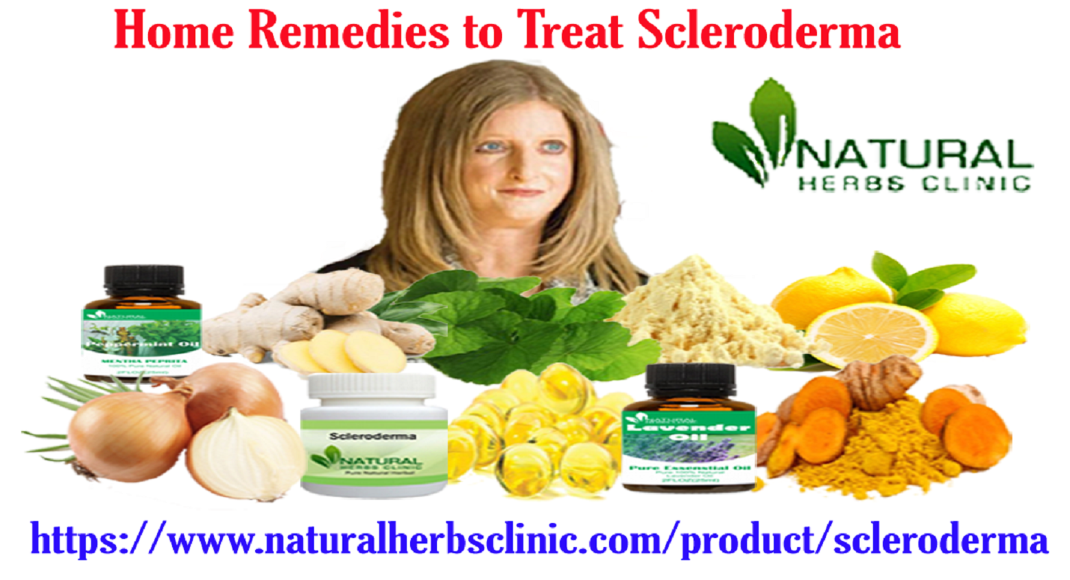 Home Remedies to Treat Scleroderma