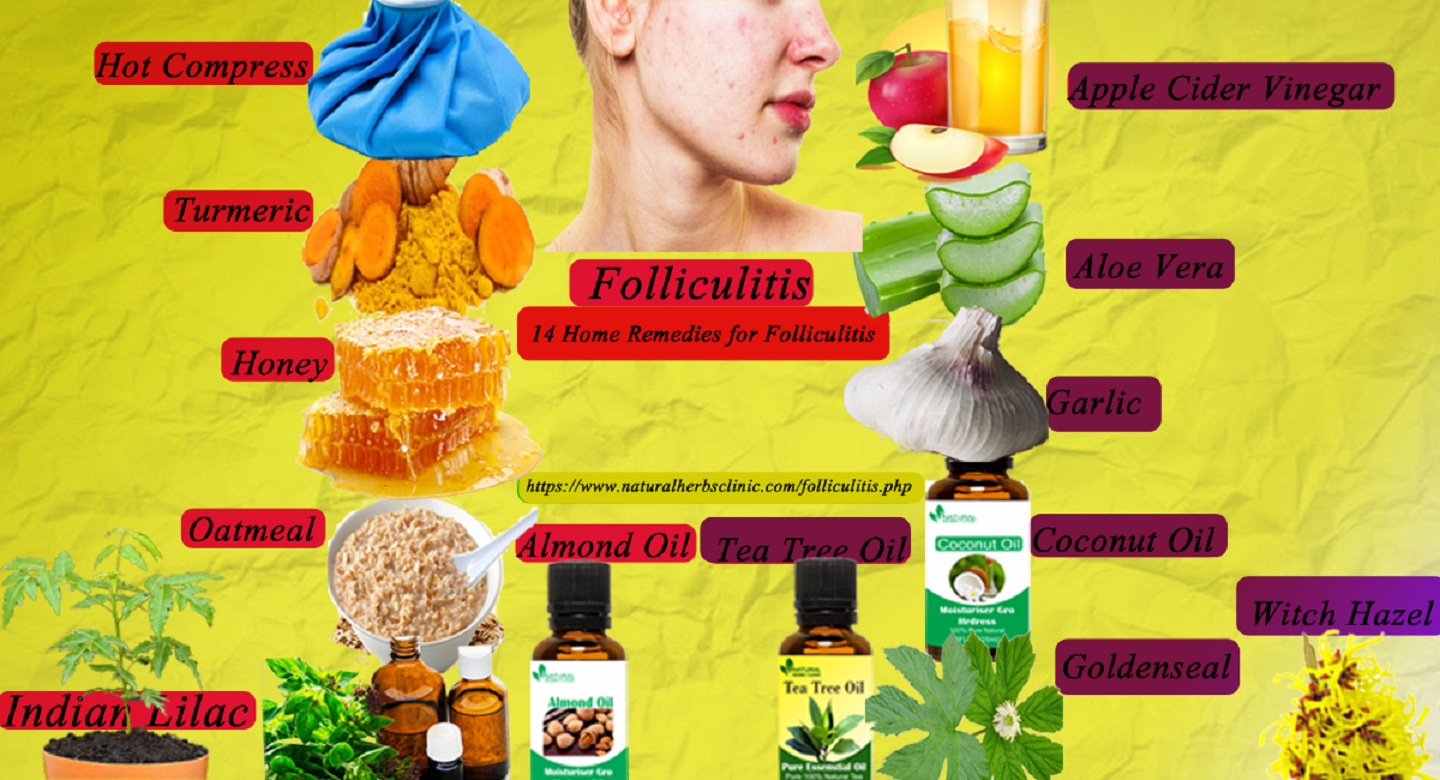14 Home Remedies for Folliculitis