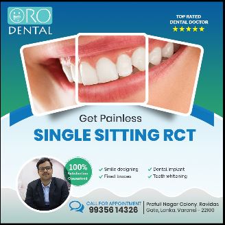 Best dental implant center in Varanasi
