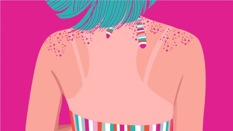 Skin Cancer - A Quick Rundown | Check-out this blog