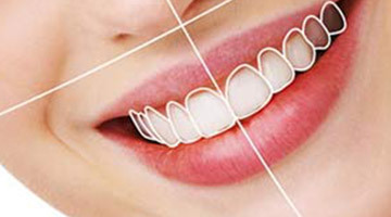Why Digital Smile Design Is Useful?