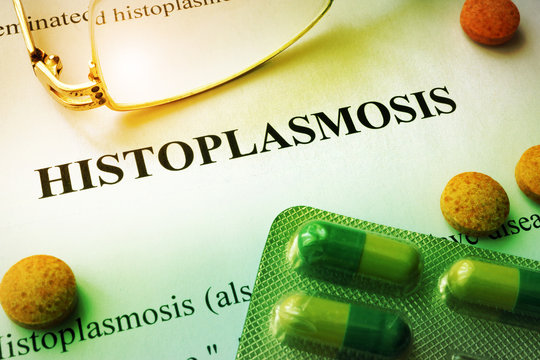 Histoplasmosis Treatment Market Insight | Outlook | Growth Analysis Report 2030