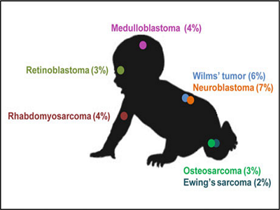 Types of Pediatric Solid Tumors | Dr. Atish Bakane