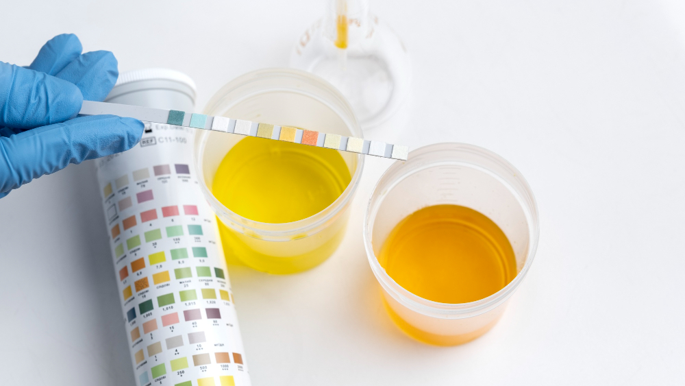 The Cost-Effectiveness of Alternatives to Drug Testing for Ensuring Workplace Safety 