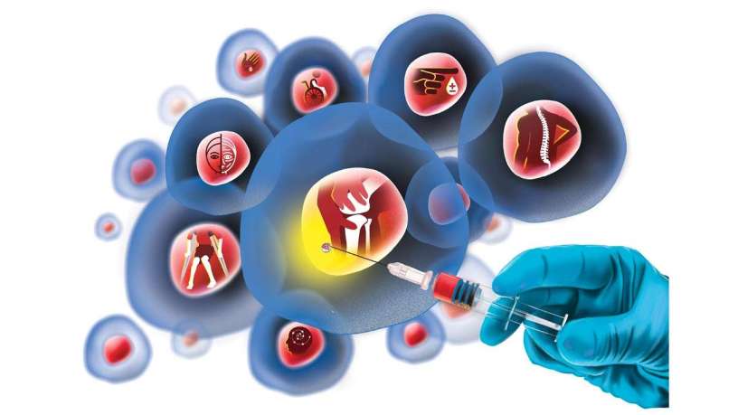 Stem Cell Therapy Market Size, Drivers, Restraints Challenges, and Growth Opportunities Till 2027