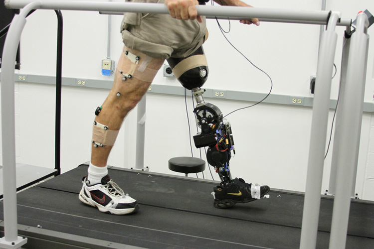Prosthetic Leg Market Outbreak: Key Trends, Growth, Insights and Forecast to 2028: COVID-19 imapct Analysis