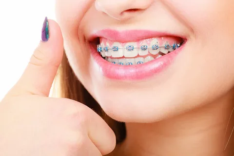 The Benefits Of Orthodontic Care: Straightening Your Smile