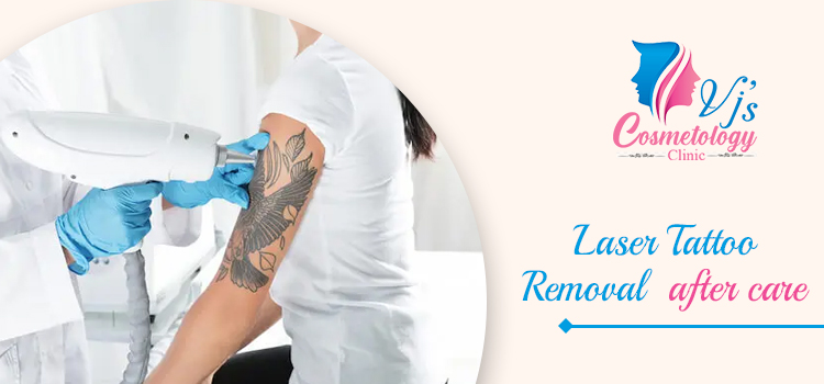 How to take care of skin following the laser tattoo removal procedure?
