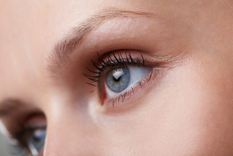 Re-Illuminate The Window Of The Soul With Eyelid Surgery!