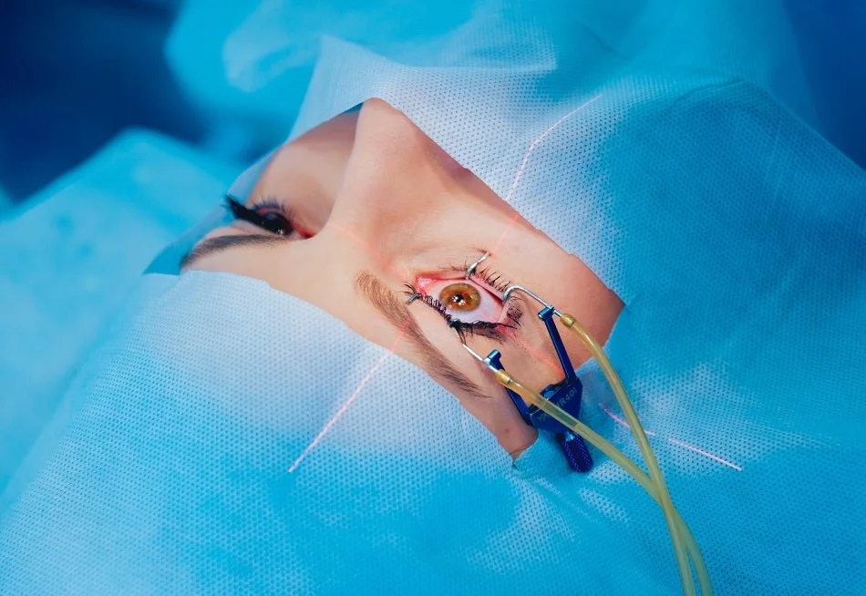 An Overview of the Process and Costs of Cataract Surgery 