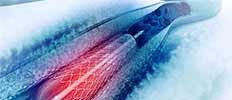 Increasing Number of Target Neurosurgical Procedures Across Major Countries