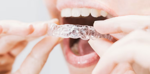 When Was The Last Time You Visited A Dentist? 
