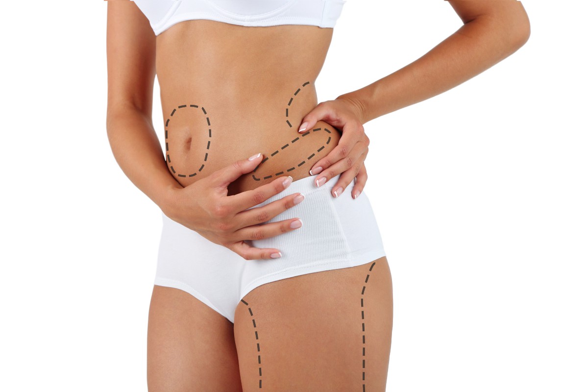 VASER LIPOSUCTION - All You Need to Know About Liposuction?