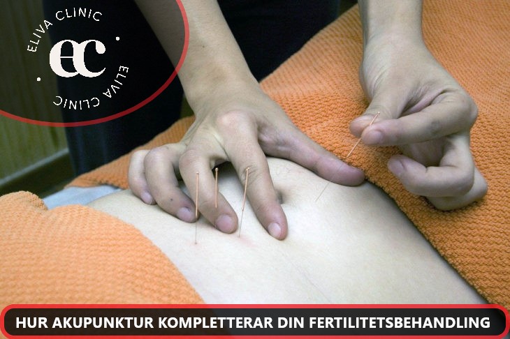 HUR AKUPUNKTUR KOMPLETTERAR DIN FERTILITETSBEHANDLING