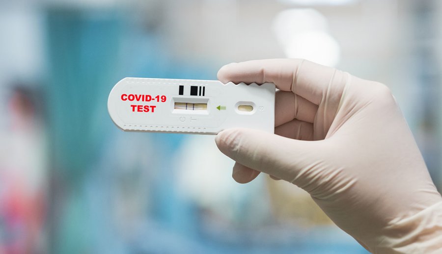 Over The Counter Test Market Size, Status, Growth | Industry Analysis Report 2022-2028