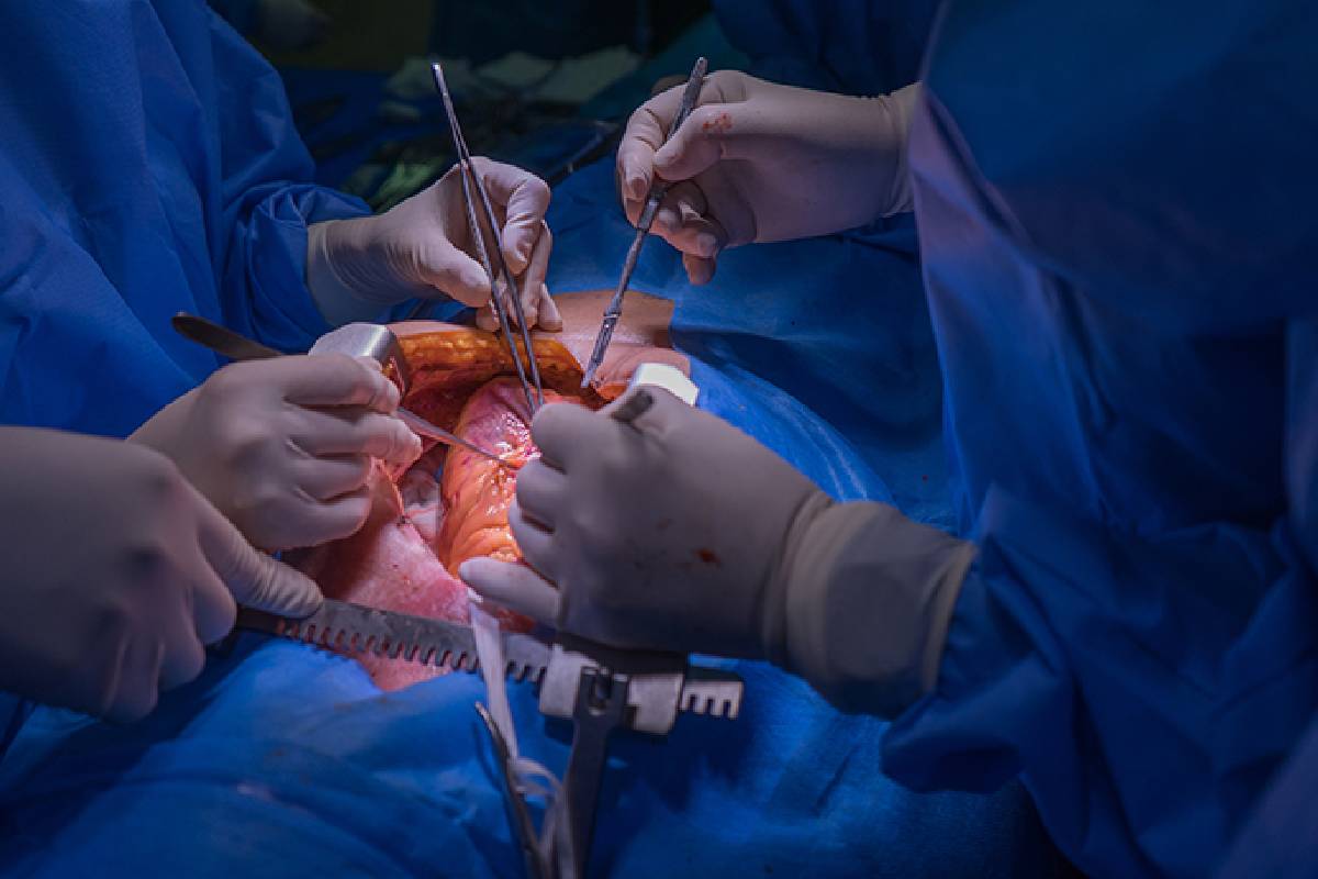 Emerging Trends in Cardiac Surgery: What's Next for Delhi's Surgeons?