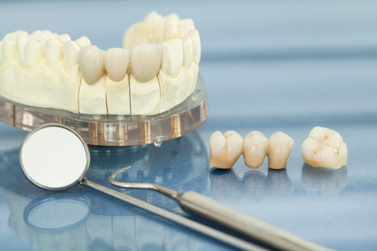 Restorative dentistry Market Is Estimated To Witness High Growth Owing To Increasing Prevalence of Dental Disorders