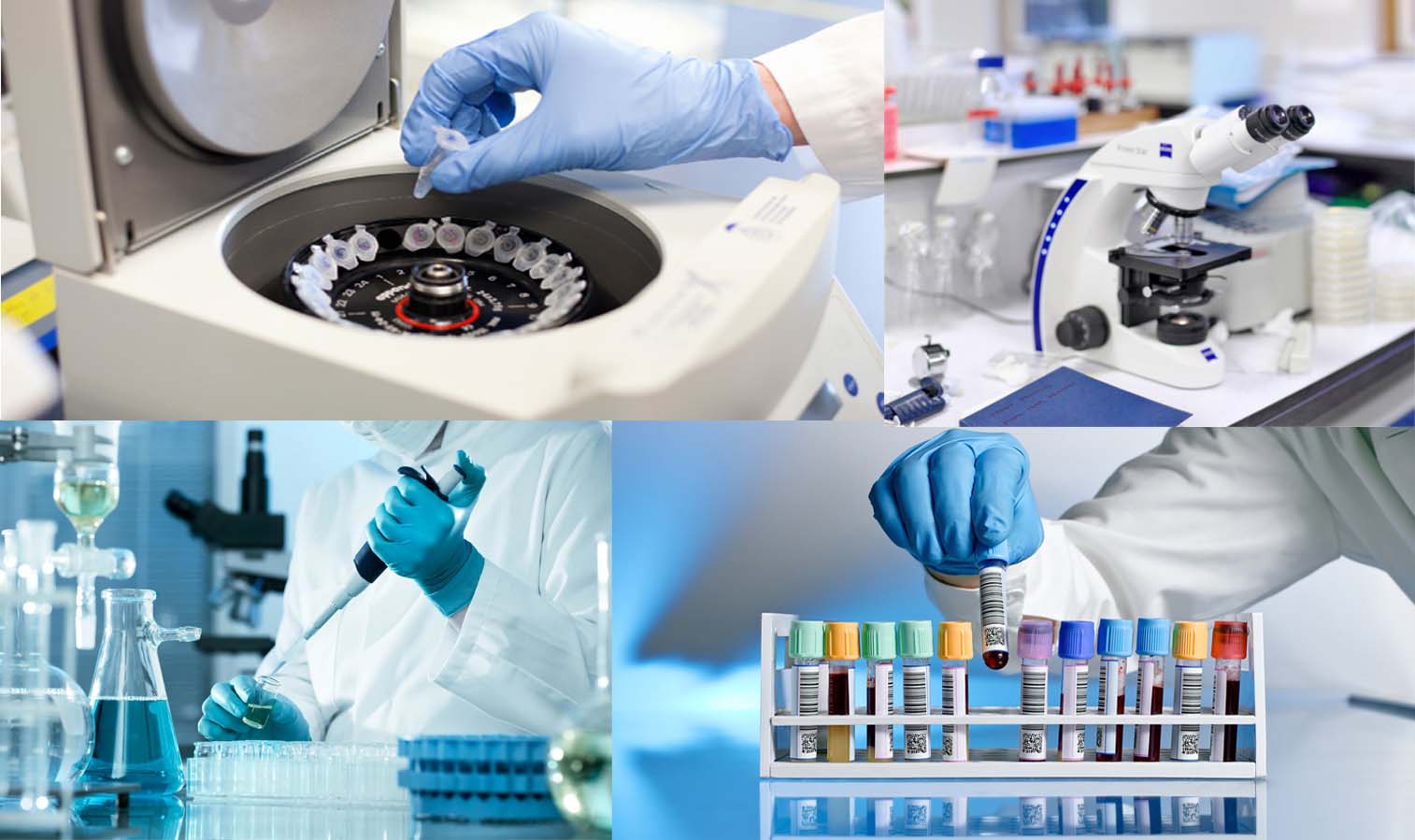 Driving Innovation in the IVD Raw Materials Market: Trends and Forecast