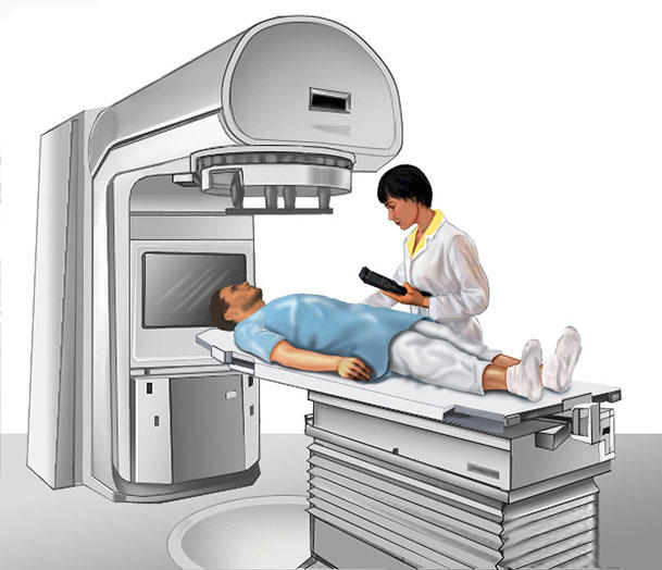 Radiotherapy Safety Measures: Minimizing Risks in Cancer Care