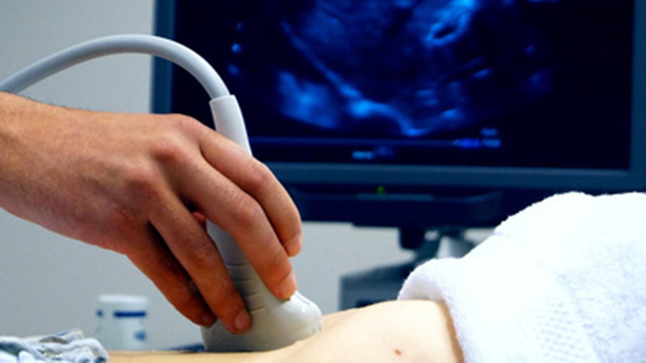 How Doppler Ultrasound Technology Works in Clinical Practice 