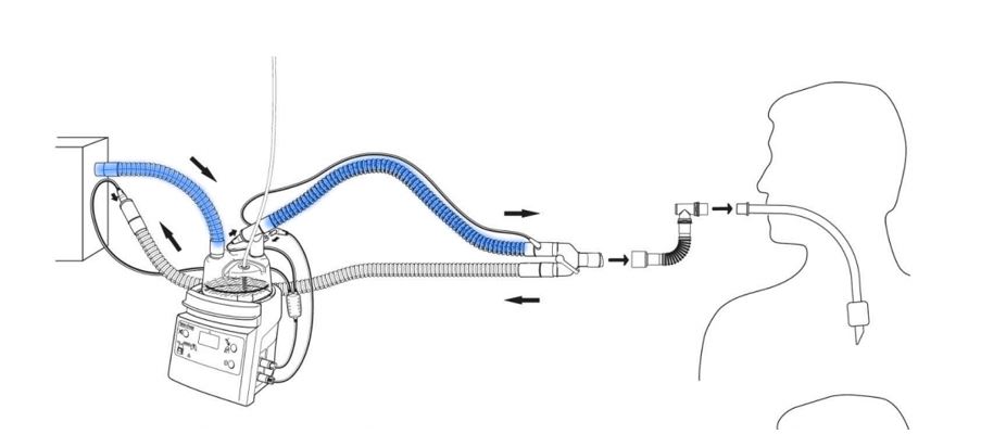 Ventilator Breathing Circuit Market: Increasing Demand for Ventilators Drives Growth