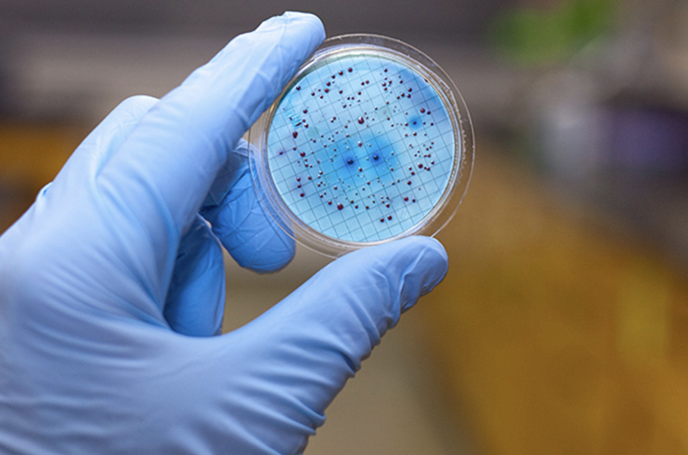 Antimicrobial Coatings Market Is Estimated To Witness High Growth Owing To Increasing Demand for Hygiene Products