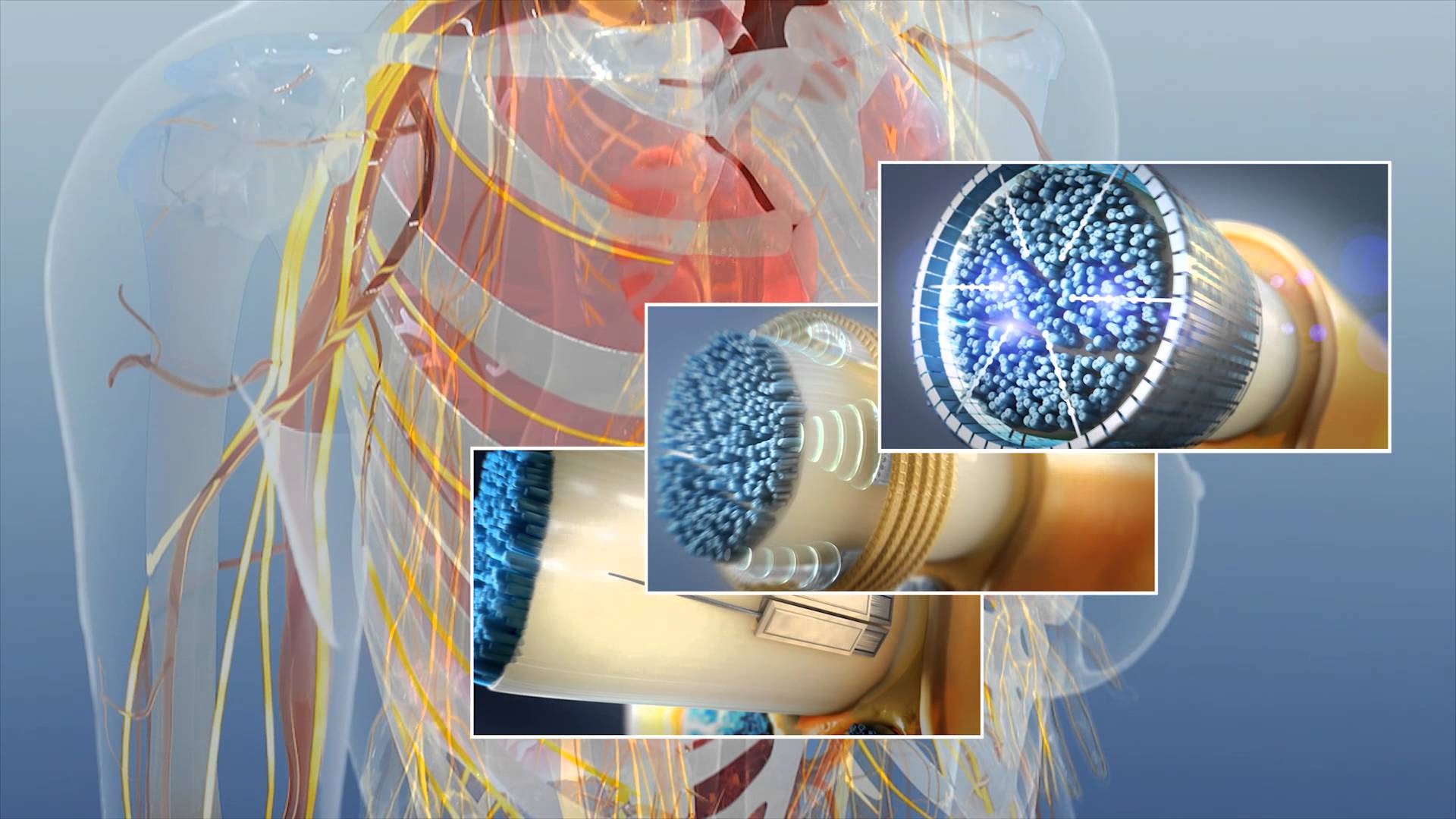 Bioelectronics Market Is Estimated To Witness High Growth Owing To Increasing Adoption of Bioelectronic Devices