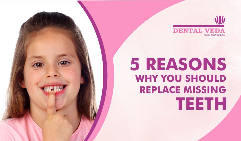 5 Reasons Why You Should Replace Missing Teeth