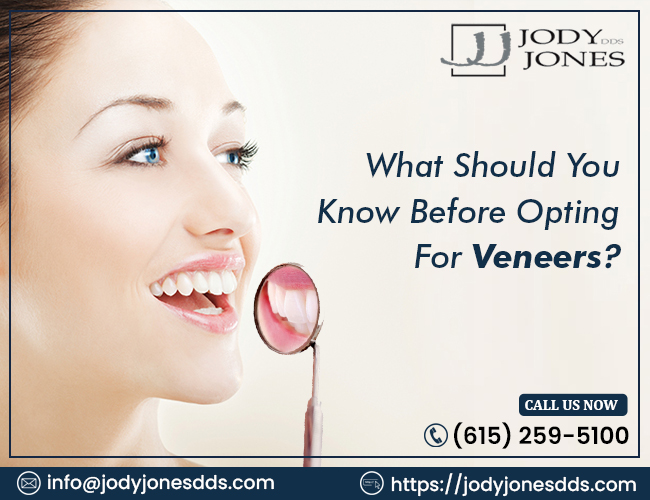 What Should You Know Before Opting for Veneers?