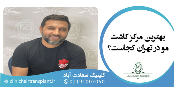 9 کشور برتر برای کاشت مو