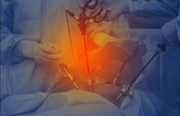 Best Laparoscopic Surgeon in Punjab