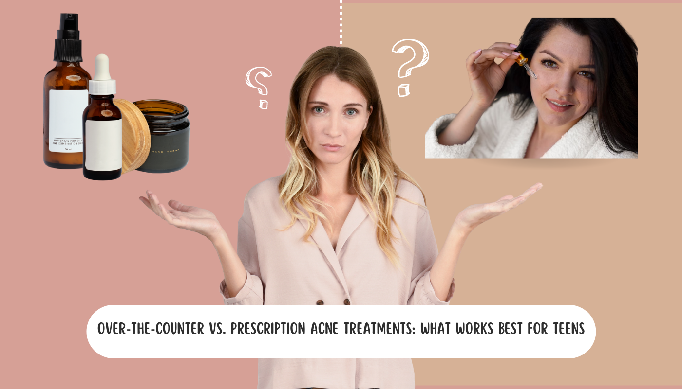 Over-the-Counter vs. Prescription Acne Treatments: What Works Best for Teens