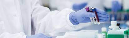 Report on Cytomegalovirus Assay Market Research 2028 - Value Market Research